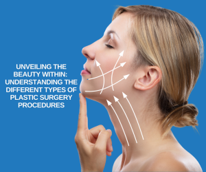 Unveiling the Beauty Within: Understanding the Different Types of Plastic Surgery Procedures